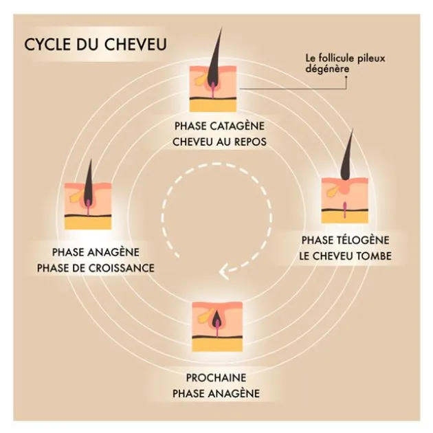 Nooance Casque LED cheveux anti-chute et repousse
