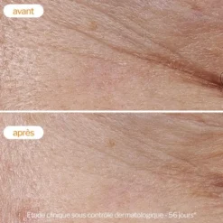 Novexpert Crème légère à la Vitamine C - 40 ml
