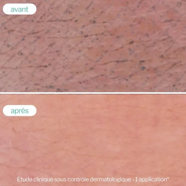 Novexpert Gelée Moussante Peau Nette - 150 ml