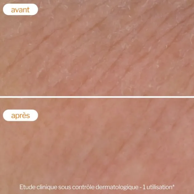 Novexpert Mousse nettoyante Flash Éclat - 150 ml