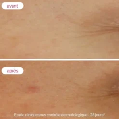 Novexpert Sérum booster à l'acide hyaluronique - 30 ml