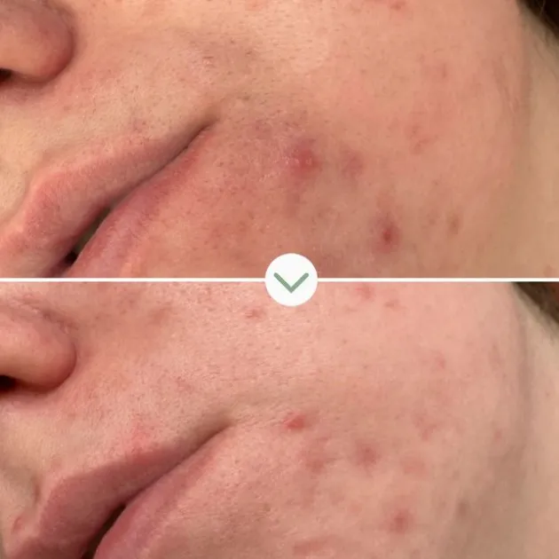 Pai Skincare Gel nettoyant Phaze - 100 ml