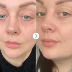 Pai Skincare Huile au rosier sauvage Bioregenerate