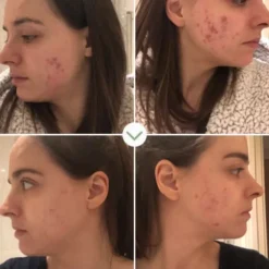 Pai Skincare Sérum Anti-Rougeurs Instant Kalmer - 30ml