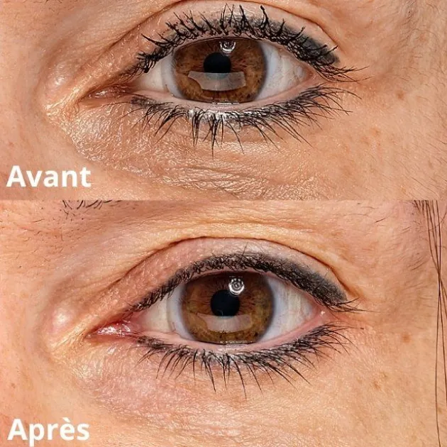 Skin Office Paris Crème contour des yeux Eye Recipe - 20 ml